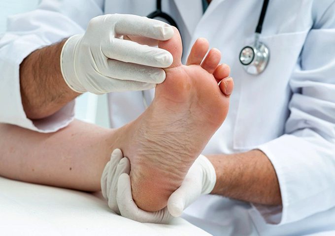 Doctor dermatologist examines the foot